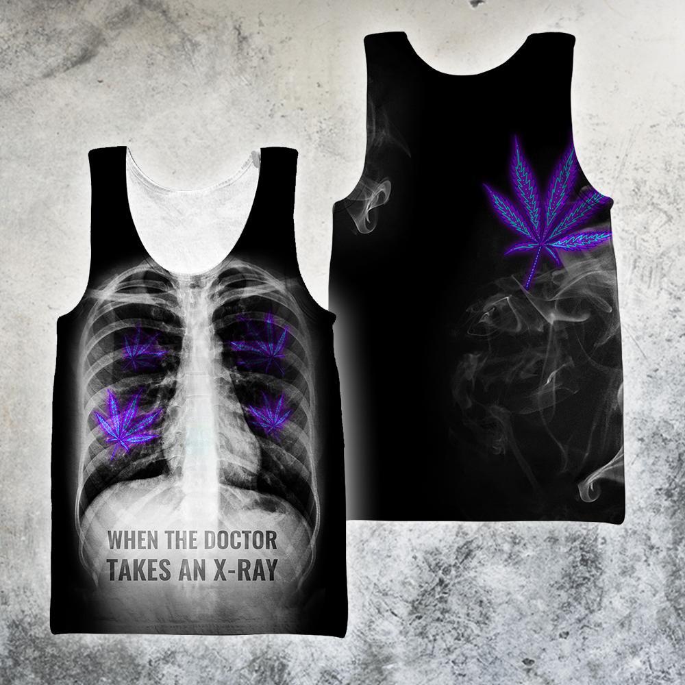 When The Doctor Takes An X-Ray 3D All Over Printed Hoodie Shirt by SUN AM080401 - Amaze Style™-Apparel