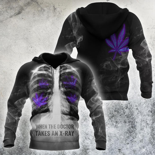 When The Doctor Takes An X-Ray 3D All Over Printed Hoodie Shirt by SUN AM080401 - Amaze Style™-Apparel