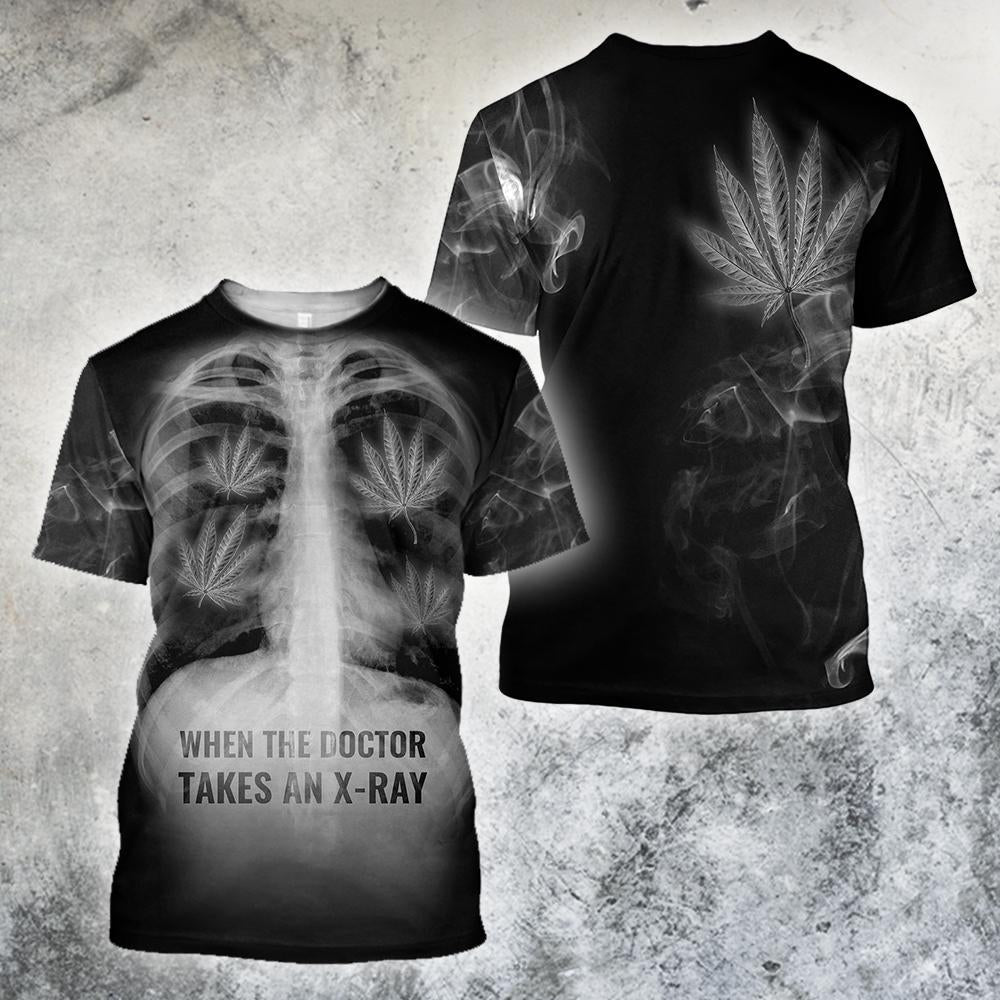 When The Doctor Takes An X-Ray 3D All Over Printed Hoodie Shirt by SUN AM080402 - Amaze Style™-Apparel