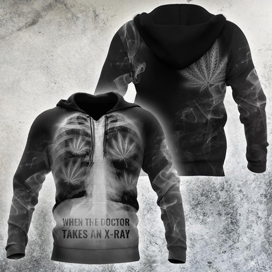 When The Doctor Takes An X-Ray 3D All Over Printed Hoodie Shirt by SUN AM080402 - Amaze Style™-Apparel