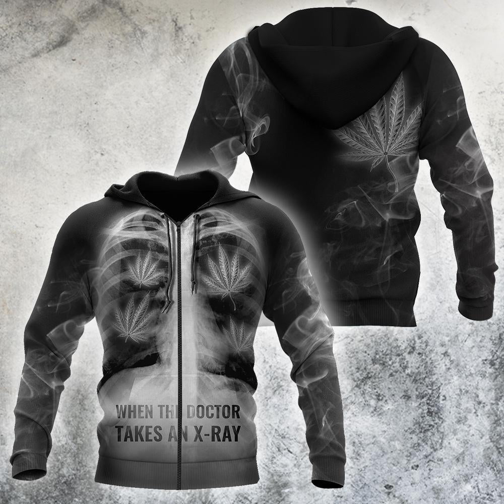 When The Doctor Takes An X-Ray 3D All Over Printed Hoodie Shirt by SUN AM080402 - Amaze Style™-Apparel